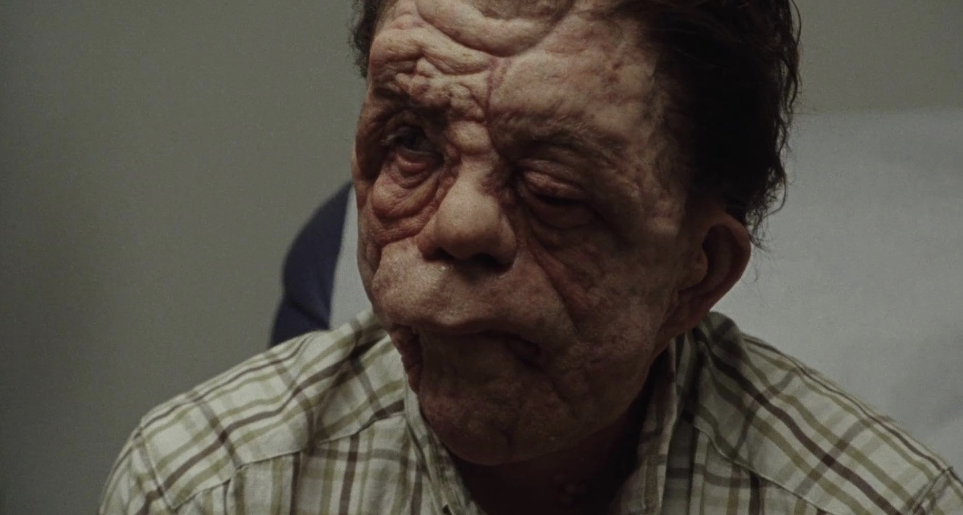 A Different Man Cast on HBO Max - Adam Pearson as Oswald